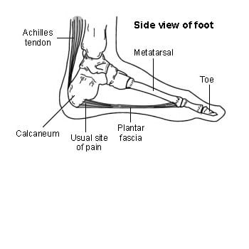plantar